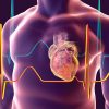 Cardiologie
