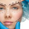 Chirurgie estetica/plastica