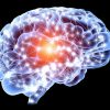 Neurologie