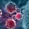Oncologie